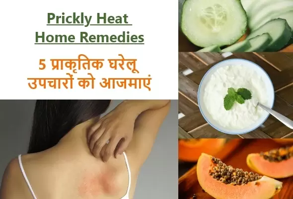 गर्मियों में घमौरियों से हैं परेशान तो छुटकारा पाने के लिए इन चीजों का करें इस्तेमाल