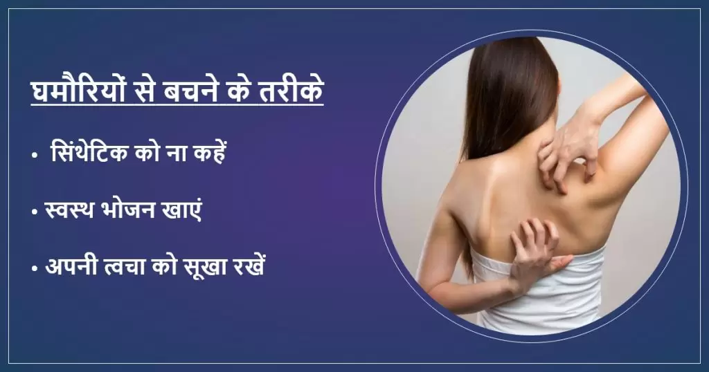 घमौरियों से बचने के तरीके