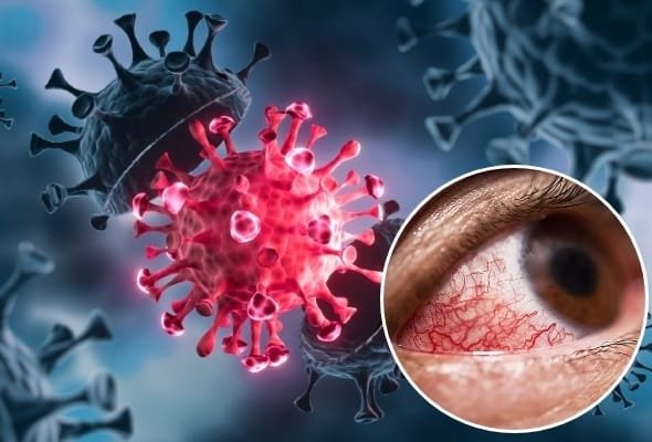 ब्लैक फंगस (Black Fungus) के बाद अब व्हाइट फंगस (White Fungus) का कहर, इन लोगों को है सबसे अधिक खतरा!